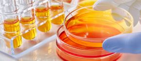 img title gloved hand holding a petri dish with an orange liquid