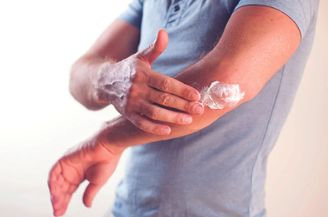 Topicals Cream Application